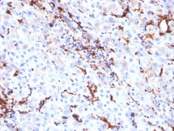 Cathepsin K Antibody / CTSK