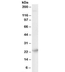 Western blot testing of human brain lysate with Synaptogyrin 4 antibody at 0.01ug/ml. Predicted mole