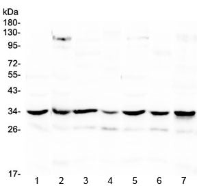 UCP2 Antibody (Middle Region)