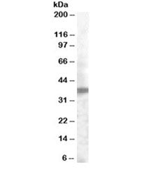 TROP2 Antibody