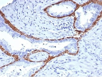Cytokeratin 14 Antibody / CK14 / KRT14