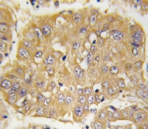 IGFBP3 Antibody