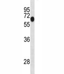 Dyrk1b Antibody