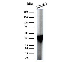 Western blot testing of human HDLM-2 cell lysate with STING1 antibody (clone STING1/7433). Predicted