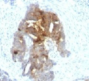 TAG-72 Antibody