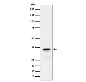 LDHC Antibody / Lactate dehydrogenase C