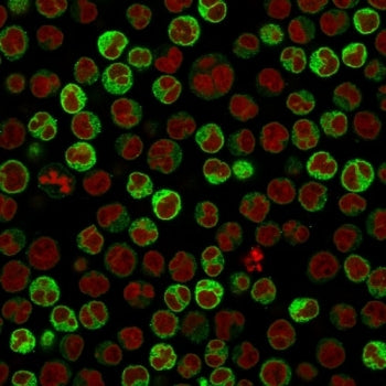 Immunofluorescent staining of PFA-fixed human Raji cells with CD79a antibody (clone ZL7-4, green) an