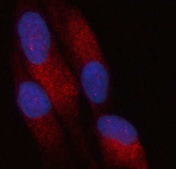 Immunofluorescent staining of FFPE human HeLa cells with PATL2 antibody (green) and DAPI nuclear sta