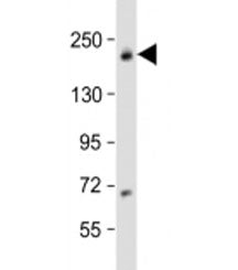 Western blot testing of human MCF-7 cell lysate with USP32 antibody at 1:1000. Predicted molecular w