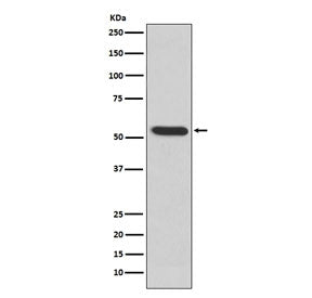 MMP3 Antibody / Matrix Metalloproteinase 3
