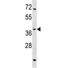 SIRT4 Antibody