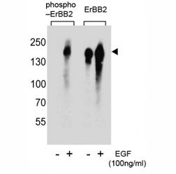 HER2 Antibody (ERBB2) (phospho-Y1005)