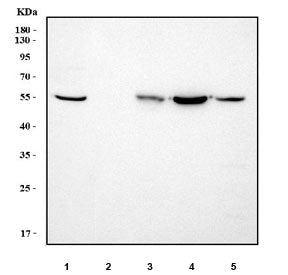 Western blot testing of 1) human HepG2, 2) human HUH7, 3) rat liver, 4) rat RH35 and 5) mouse liver 