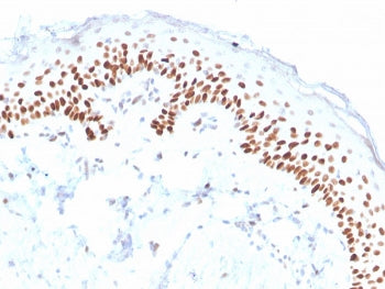 IHC staining of FFPE human skin with deltaNp63 antibody (clone ZR8). HIER: boil tissue sections in p