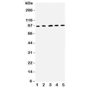 Western blot testing of ICAM1 antibody and rat samples 1: thymus; 2: spleen; 3: PC12; 4: NRK; 5: RH3