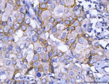 HER2 Antibody / ErbB2