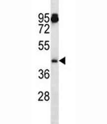 Aurora-A Antibody (Aurka)