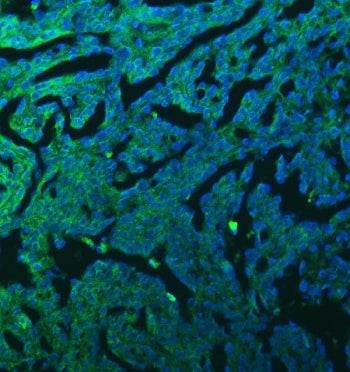 Sideroflexin-3 Antibody / SFXN3