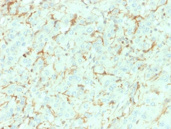 NGF Receptor Antibody / p75NTR / CD271