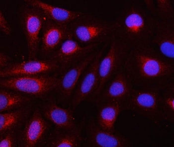 REEP3 Antibody / Receptor expression-enhancing protein 3