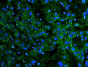 N-Cadherin Antibody / CDH2