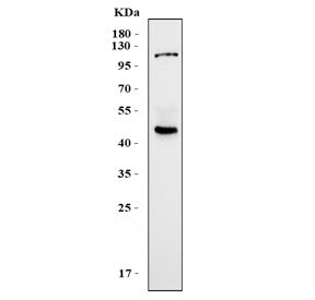 Western blot testing of human placental tissue lysate with KCa3.1 antibody. Predicted molecular weig
