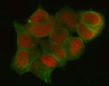 Immunofluorescent staining of FFPE human T-47D cells with CTBP1 antibody (red) and Alpha Tubulin mAb