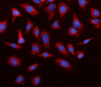 Immunofluorescent staining of FFPE mouse RM-1 cells with Elovl4 antibody (red) and DAPI nuclear stai