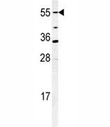 CYP26A1 Antibody