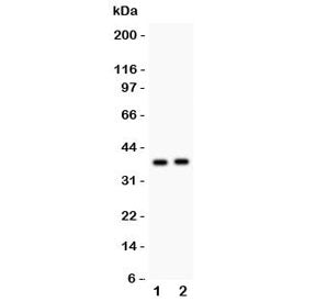 Western blot testing of Calretinin antibody and Lane 1: rat brain; 2: mouse brain lysate. Expected molecular weight: ~29KD, observed size ~37kDa.