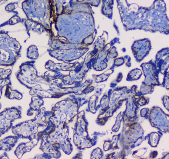 IHC testing of FFPE human placental tissue with ITGA5 antibody. Required HIER: steam section in pH6 