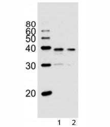 Western blot analysis of lysate from 1) PC3, and 2) LNCaP cell line using VDR antibody at 1:1000. Pr
