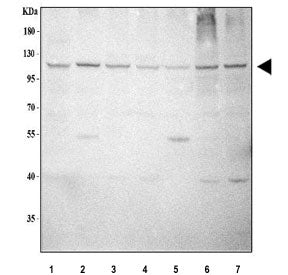 L1TD1 Antibody / ECAT11