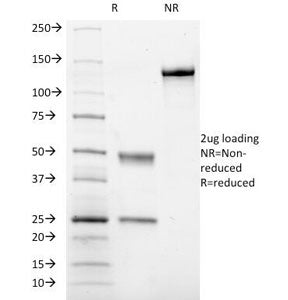 SDS-PAGE Analysis of Purified, BSA-Free CD41 Antibody (clone ITGA2B/1036). Confirmation of Integrity