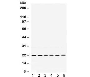 Western blot testing of 1) rat spleen, 2) rat stomach, 3) rat intestine, 4) human MCF7, 5) human A54