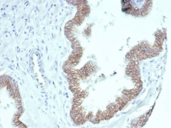 Beta Catenin Antibody