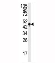 Western blot analysis of Neuron Specific Enolase antibody and Y79 lysate. Predicted molecular weight