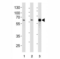 HDAC1 antibody western blot analysis in (1) HeLa, (2) WiDr, and (3) Jurkat lysate. Predicted molecul