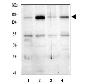 Western blot analysis of human 1) HeLa, 2) MCF7, 3) U-87 MG, and 4) U-251 cell lysates using Thrombo