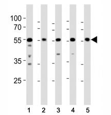 Src Antibody