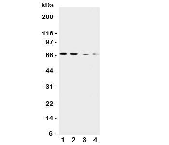 Western blot testing of CAT1 antibody and Lane 1: human placenta; 2: HeLa; 3: SKOV-3; 4: HT1080 cell lysate. Expected molecular weight ~68 kDa.