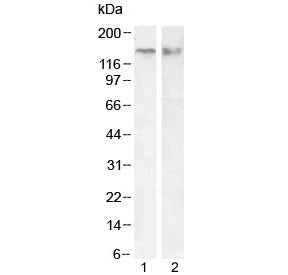 Western blot testing of human 1) Jurkat whole cell and 2) Jurkat nuclear fraction lysate with CTCF a