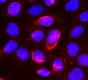 Immunofluorescent staining of FFEP human A431 cells with Beta Glucuronidase antibody (red) and DAPI 