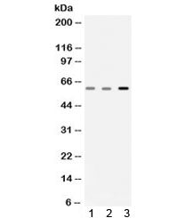 Western blot testing of 1) rat skeletal muscle, 2) mouse skeletal muscle and 3) human A549 lysate wi