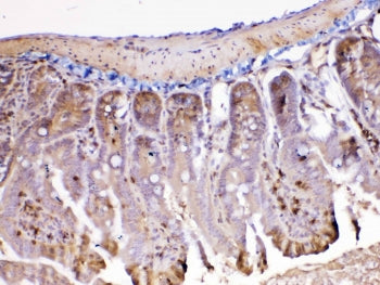 Ada Antibody / Adenosine deaminase