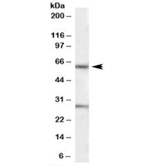 KCNQ1 Antibody