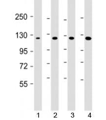 Western blot testing of 1) human DU-145, 2) human HepG2, 3) mouse brain and 4) HeLa cell lysate with