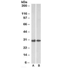 Galectin 3 Antibody