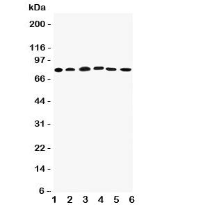 Western blot testing of Proprotein Convertase 1/3 antibody; Lane 1: rat liver; 2: (r) thymus; and hu