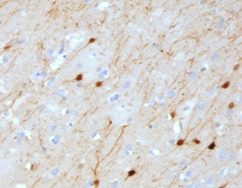 Calbindin 2 Antibody / CALB2 / Calretinin